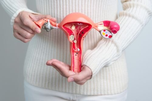 Fibroid & Cyst Management