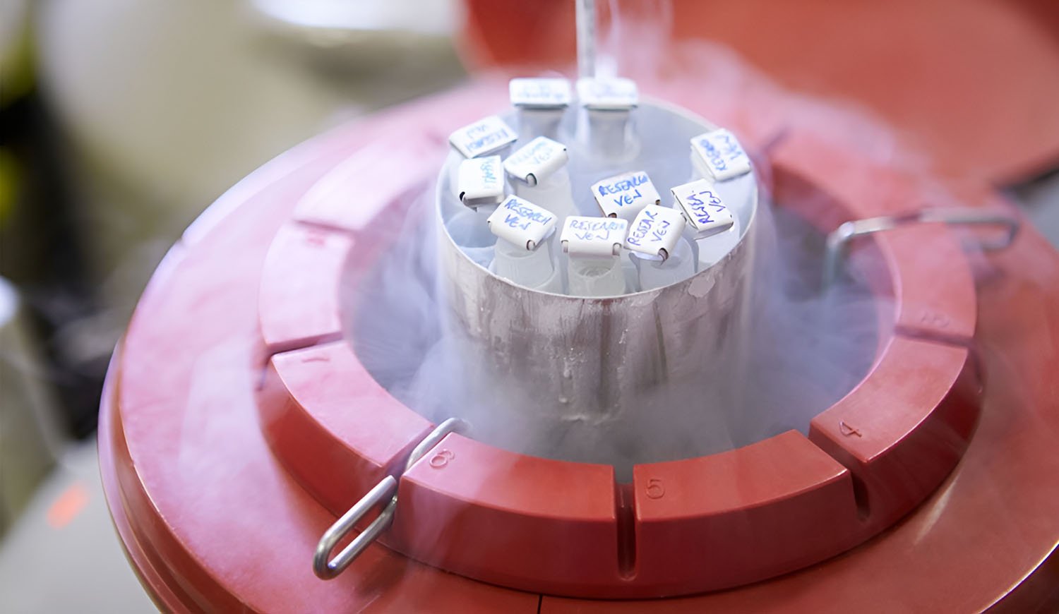 Cryopreservation (Egg, Sperm & Embryo Freezing)