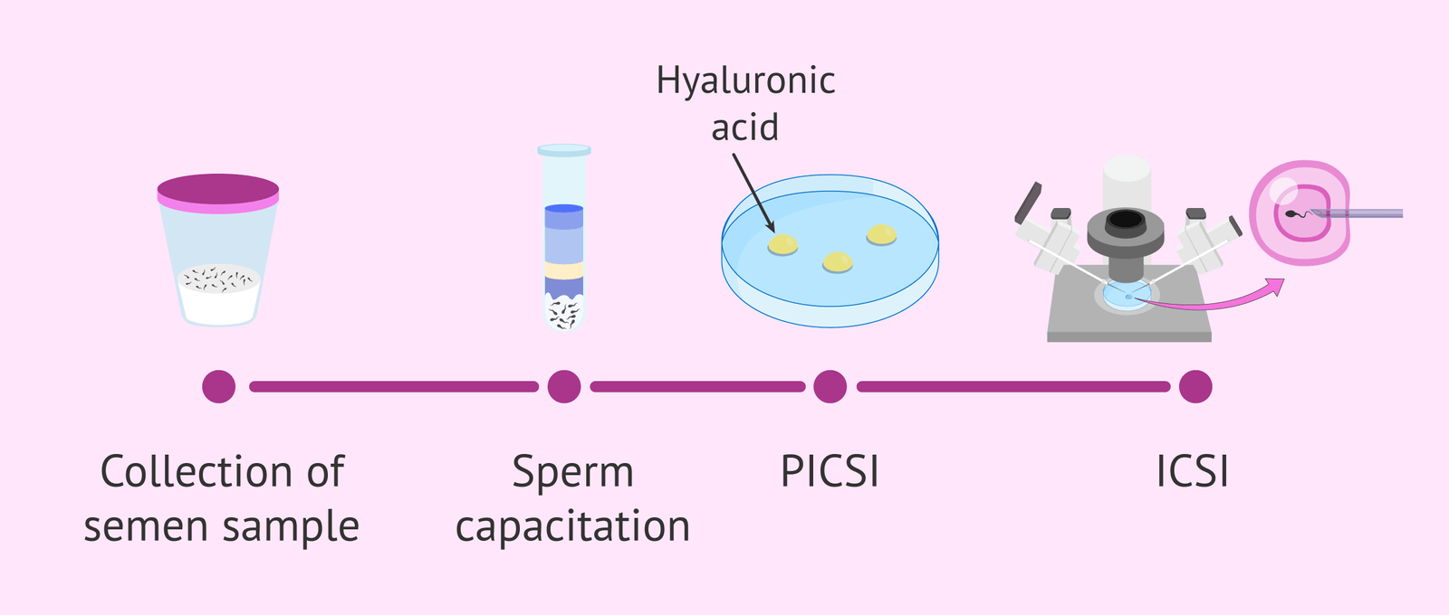 IMSI / PICSI techniques