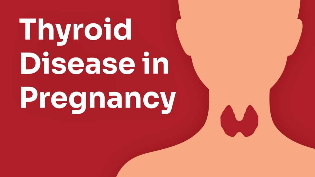 Thyroid disorders in pregnancy