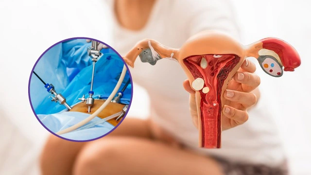 Endometriosis specialist in Nagpur