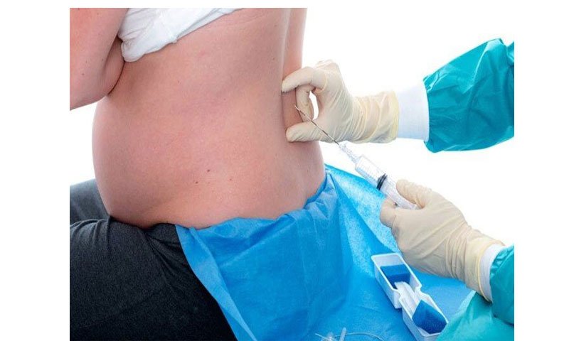 Painless delivery in Nagpur