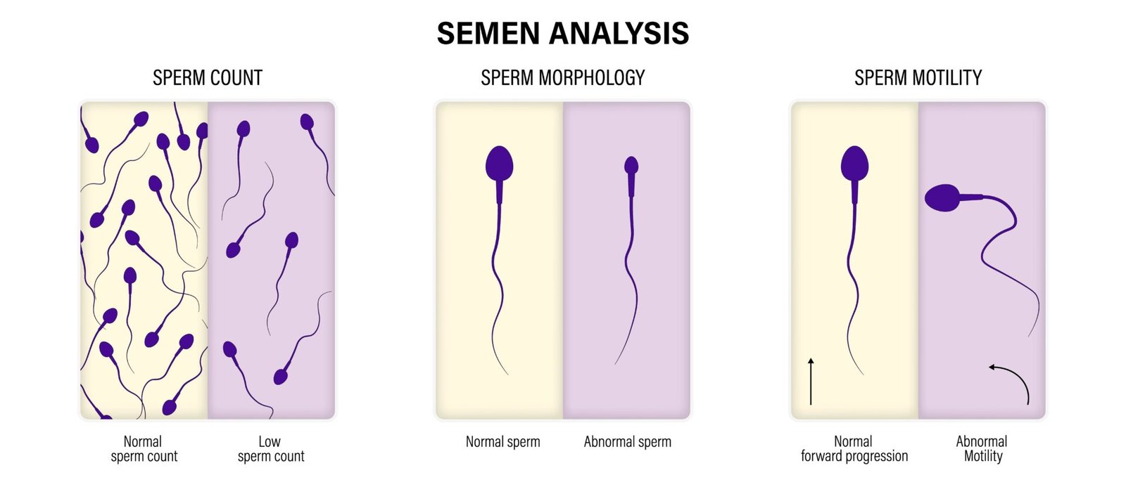 Semen analysis in Nagpur